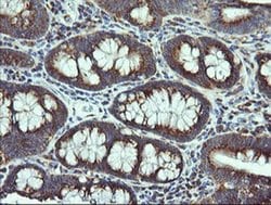 Invitrogen VTI1A Monoclonal Antibody (OTI1F4) 100 &mu;L; Unconjugated:Antibodies,