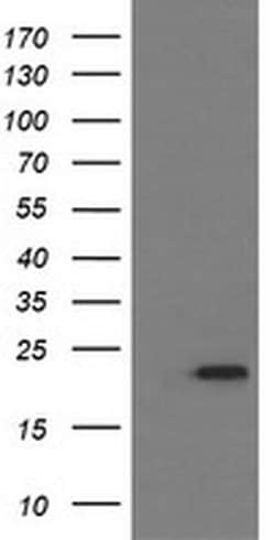 Invitrogen LZIC Monoclonal Antibody (OTI1D5) 100 &mu;L; Unconjugated:Antibodies,