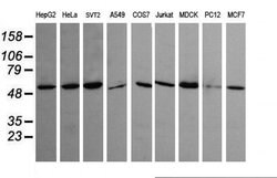 Invitrogen TRIM45 Monoclonal Antibody (OTI4F1) 100 &mu;L; Unconjugated:Antibodies,