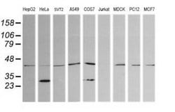 Invitrogen PARVA Monoclonal Antibody (OTI1H2) 100 &mu;L; Unconjugated:Antibodies,