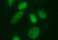 SAE1 Monoclonal Antibody (OTI1G8):Antibodies, Monoclonal