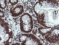 SAE1 Monoclonal Antibody (OTI1G8):Antibodies, Monoclonal