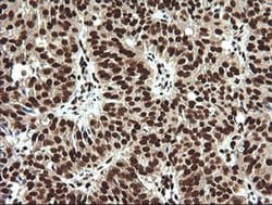 SAE1 Monoclonal Antibody (OTI1G8):Antibodies, Monoclonal