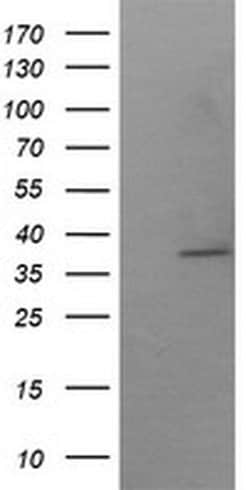 SAE1 Monoclonal Antibody (OTI1G8):Antibodies, Monoclonal
