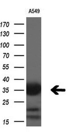 Invitrogen RARRES1 Monoclonal Antibody (OTI1B8) 100 &mu;L; Unconjugated:Antibodies,