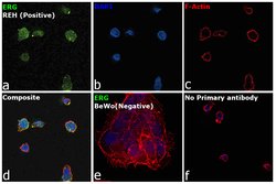 Invitrogen ERG Monoclonal Antibody (OTI8A9) 100 &mu;L; Unconjugated:Antibodies,