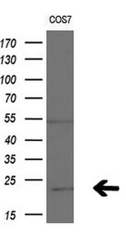 Invitrogen APC11 Monoclonal Antibody (OTI3F5) 100 &mu;L; Unconjugated:Antibodies,