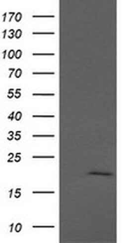 Invitrogen APC11 Monoclonal Antibody (OTI3F5) 100 &mu;L; Unconjugated:Antibodies,