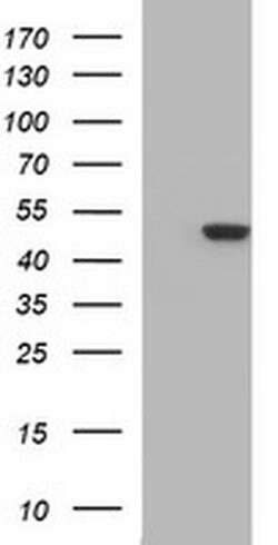 Invitrogen TUBB2B Monoclonal Antibody (OTI6D11) 100 &mu;L; Unconjugated:Antibodies,