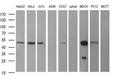 Invitrogen TUBB2B Monoclonal Antibody (OTI6D11) 100 &mu;L; Unconjugated:Antibodies,