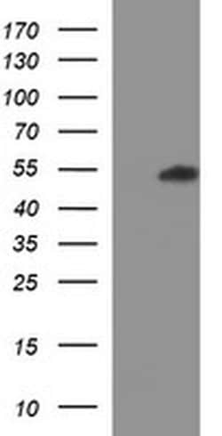 Invitrogen RUNDC3A Monoclonal Antibody (OTI3C6) 100 &mu;L | Buy Online | Invitrogen&trade; | Fisher Scientific