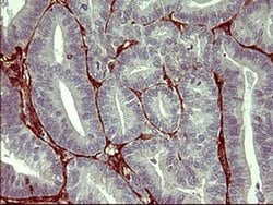 Invitrogen PPAP2A Monoclonal Antibody (OTI1H4) 100 &mu;L; Unconjugated:Antibodies,