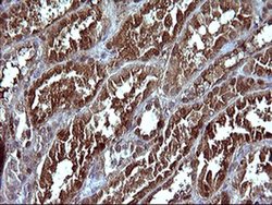 Invitrogen SERPINB3 Monoclonal Antibody (OTI1A12) 100 &mu;L | Buy Online | Invitrogen&trade; | Fisher Scientific