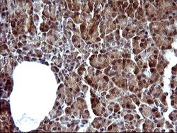 Invitrogen SERPINB3 Monoclonal Antibody (OTI1A12) 100 &mu;L | Buy Online | Invitrogen&trade; | Fisher Scientific