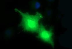 Invitrogen HRASLS3 Monoclonal Antibody (OTI1A5) 100 &mu;L; Unconjugated:Antibodies,