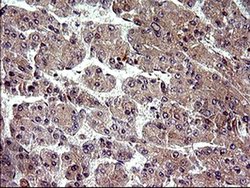 Invitrogen HRASLS3 Monoclonal Antibody (OTI1A5) 100 &mu;L; Unconjugated:Antibodies,