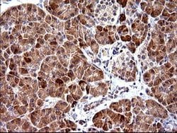 Invitrogen HRASLS3 Monoclonal Antibody (OTI1A5) 100 &mu;L; Unconjugated:Antibodies,