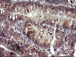 Invitrogen HRASLS3 Monoclonal Antibody (OTI1A5) 100 &mu;L; Unconjugated:Antibodies,