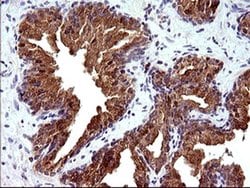 Invitrogen HRASLS3 Monoclonal Antibody (OTI1A5) 100 &mu;L; Unconjugated:Antibodies,