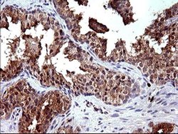 Invitrogen HRASLS3 Monoclonal Antibody (OTI1A5) 100 &mu;L; Unconjugated:Antibodies,