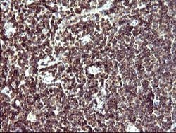 Invitrogen IL10RA Monoclonal Antibody (OTI1D10) 100 &mu;L; Unconjugated:Antibodies,