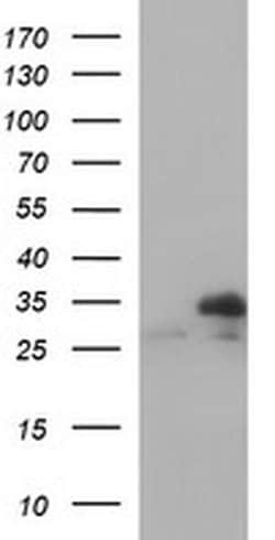 Invitrogen TMX Monoclonal Antibody (OTI1C1) 100 &mu;L; Unconjugated:Antibodies,