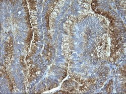Invitrogen SCAMP2 Monoclonal Antibody (OTI1H10) 100 &mu;L; Unconjugated:Antibodies,