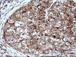 Invitrogen SCAMP2 Monoclonal Antibody (OTI1H10) 100 &mu;L; Unconjugated:Antibodies,