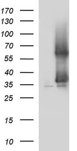 Invitrogen SCAMP2 Monoclonal Antibody (OTI1H10) 100 &mu;L; Unconjugated:Antibodies,