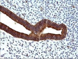 Invitrogen HSD17B4 Monoclonal Antibody (OTI4C4) 100 &mu;L | Buy Online | Invitrogen&trade; | Fisher Scientific