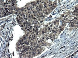 Invitrogen CEP68 Monoclonal Antibody (OTI5D8) 100 &mu;L; Unconjugated:Antibodies,