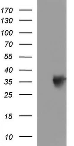 Invitrogen TOLLIP Monoclonal Antibody (OTI2A4) 100 &mu;L; Unconjugated:Antibodies,