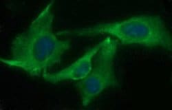 Invitrogen CHAC1 Monoclonal Antibody (OTI4A11) 100 &mu;L; Unconjugated:Antibodies,