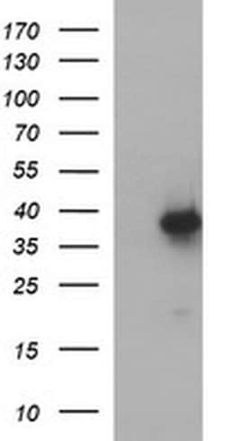 Invitrogen MCAT Monoclonal Antibody (OTI2G1) 100 &mu;L | Buy Online | Invitrogen&trade; | Fisher Scientific