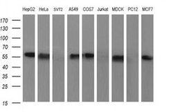 Invitrogen SR-BI Monoclonal Antibody (OTI1F3) 100 &mu;L; Unconjugated:Antibodies,