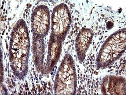 Invitrogen SHBG Monoclonal Antibody (OTI1H10) 100 &mu;L; Unconjugated:Antibodies,