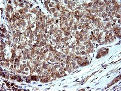 Invitrogen SHBG Monoclonal Antibody (OTI1H10) 100 &mu;L; Unconjugated:Antibodies,