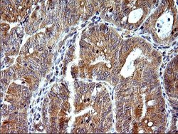 Invitrogen SHBG Monoclonal Antibody (OTI1H10) 100 &mu;L; Unconjugated:Antibodies,