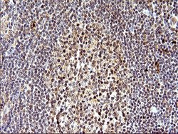 Invitrogen SHBG Monoclonal Antibody (OTI1H10) 100 &mu;L; Unconjugated:Antibodies,