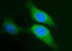 Invitrogen SPHK1 Monoclonal Antibody (OTI1A6) 100 &mu;L; Unconjugated:Antibodies,