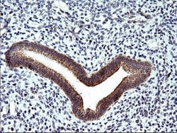Invitrogen SPHK1 Monoclonal Antibody (OTI1A6) 100 &mu;L; Unconjugated:Antibodies,