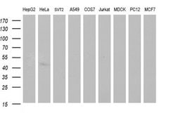 Invitrogen SPHK1 Monoclonal Antibody (OTI1A6) 100 &mu;L; Unconjugated:Antibodies,