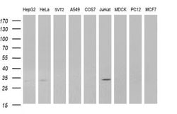 Invitrogen ANR49 Monoclonal Antibody (OTI3E4) 100 &mu;L | Buy Online | Invitrogen&trade; | Fisher Scientific