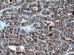 Invitrogen SCP2 Monoclonal Antibody (OTI1D2) 100 &mu;L; Unconjugated:Antibodies,