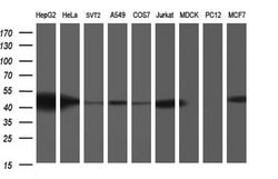 Invitrogen TXNDC5 Monoclonal Antibody (OTI1C3) 100 &mu;L; Unconjugated:Antibodies,