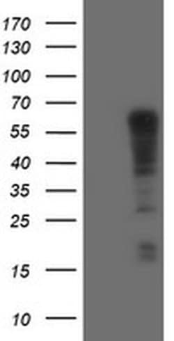 Invitrogen TRIM9 Monoclonal Antibody (OTI2A1) 100 &mu;L; Unconjugated:Antibodies,