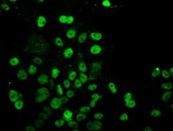 Invitrogen UBE2E3 Monoclonal Antibody (OTI4C8) 100 &mu;L; Unconjugated:Antibodies,