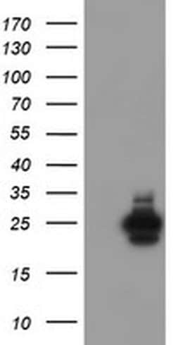 Invitrogen UBE2E3 Monoclonal Antibody (OTI4C8) 100 &mu;L; Unconjugated:Antibodies,