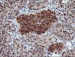 Invitrogen UBE2E3 Monoclonal Antibody (OTI7E8) 100 &mu;L; Unconjugated:Antibodies,