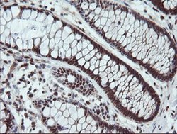 Invitrogen UBE2E3 Monoclonal Antibody (OTI7E8) 100 &mu;L; Unconjugated:Antibodies,